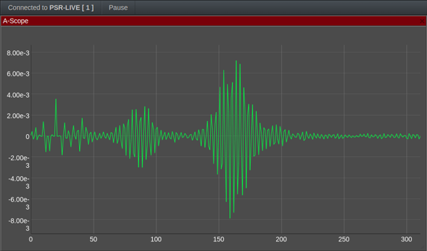 Tutorial-Using-the-NextGen-8-GHz-Pulse-Module-for-Artificial-Intelligence-to-Understand-Finger-Counting-Based-Gestures-19